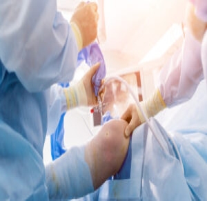 Arthroscopic Procedures - How They Work and Help